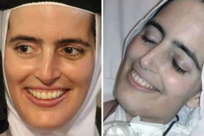 Bắt đầu tiến trình mở án phong thánh cho nữ tu Argentina nổi tiếng với nụ cười cuối đời